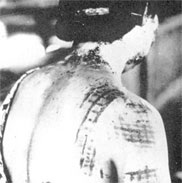 Aug. 1945: An atomic bomb survivor suffers from having portions of her kimono burned into her skin. Source: National Archives and Records Administration; U.S. Army; American Memory (http://memory. loc.gov)