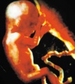 Abortion fetus-apva-090313.jpg